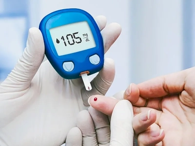 Apa yang perlu Anda ketahui?