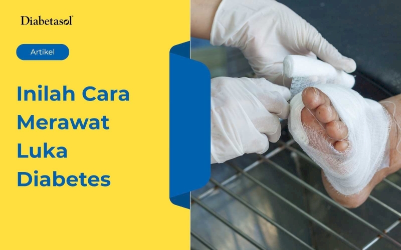 Inilah Cara Merawat Luka Diabetes